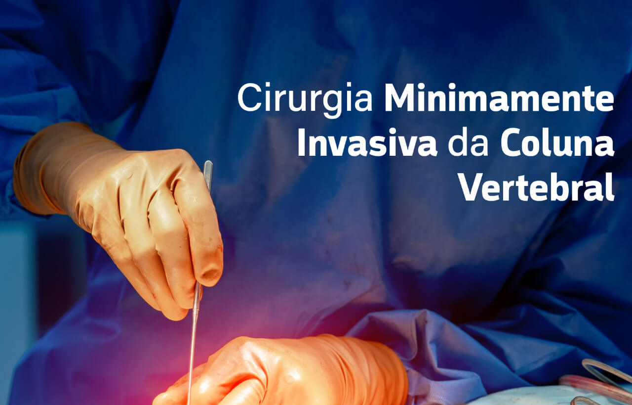 Para quais casos é recomendado e quando optar pela cirurgia minimamente invasiva da coluna