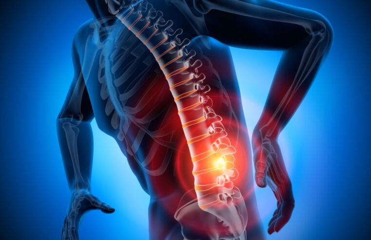 Quando a Cirurgia da Coluna é Indicada para Alívio da Dor Lombar Crônica